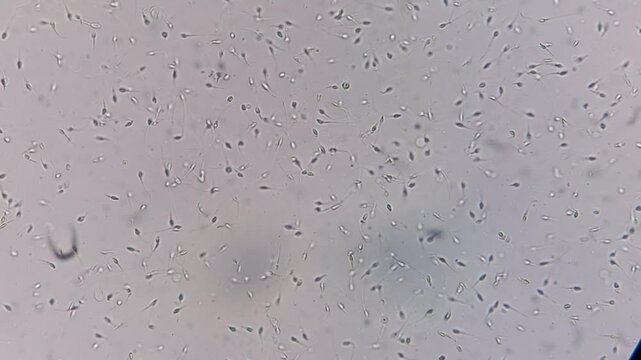 Microscopic footage of semen normozoospermia sperm count. Normal semen analysis on microscopic examination.