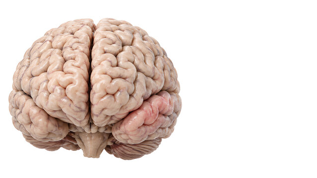 Alzheimer disease brain with subtle neuroinflammation and atrophy, photorealistic medical illustration on white background with copy space for neurology, patient education and healthcare communication