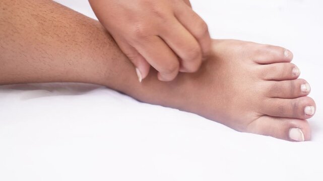 Indian Young woman scratching the itch on her feet, Cause of itchy skin include athlete's foot (fungal infection), dermatitis (eczema), psoriasis, or bug bites. Health care concept.