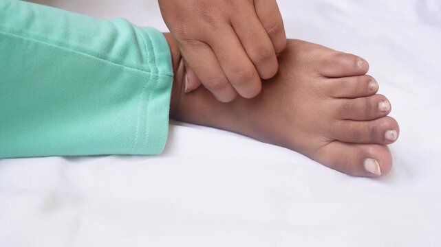 Indian Young woman scratching the itch on her feet, Cause of itchy skin include athlete's foot (fungal infection), dermatitis (eczema), psoriasis, or bug bites. Health care concept.