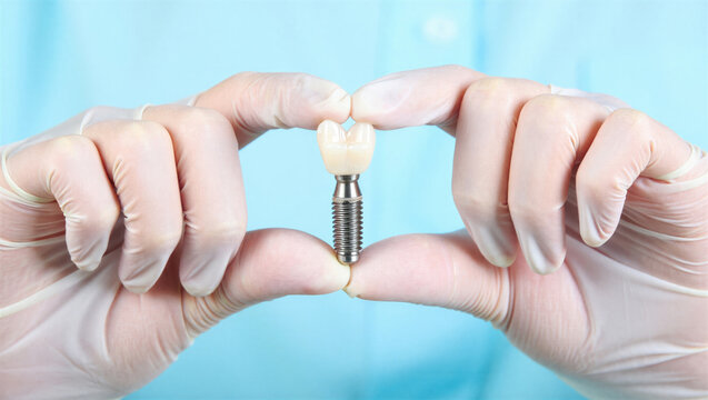Gloved dental professional holds a dental implant with a ceramic crown against a blue clinical background, showing restorative dentistry and oral healthcare.