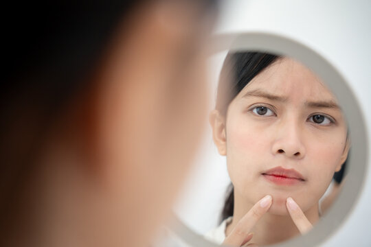 Young woman asian are worried about faces Dermatology and allergic to steroids in cosmetics. sensitive skin, red face from sunburn, acne, allergic to chemicals, rash on face. skin problems and beauty