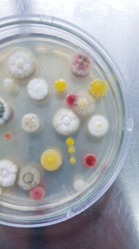 Colorful microbial colonies of different shapes and sizes grow on agar medium in a clear petri dish, typical of microbiological research.