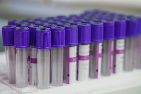 Blood test tubes with colorful caps in a lab.