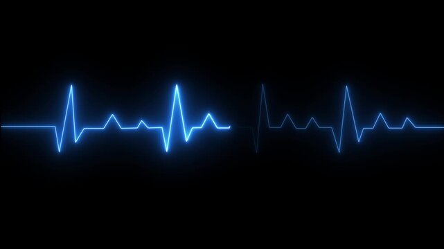 Electrocardiogram heartbeat pulse line animation with glowing blue neon waveform representing heart rhythm cardiac monitoring medical technology healthcare diagnostics and futuristic medicine