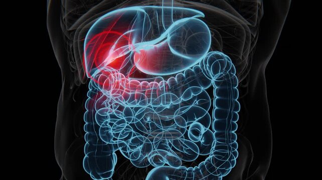 Gallstone pain is discomfort caused by gallstones blocking the bile ducts, often felt in the upper right or upper middle abdomen video in 4K | Gallstone pain indication Video in 4K UHD