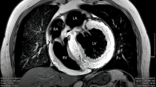 Anatomical cardiac magnetic resonance scan