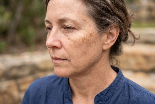 Close up portrait of adult woman with visible sun damage and fine lines on cheek skin