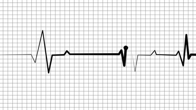 Medical heartbeat line on graph paper with a medical monitor style wave animation