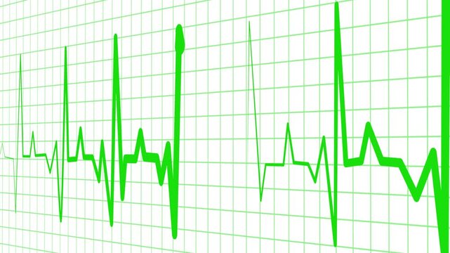 Heart rhythm line showing an electrocardiogram pattern medical background with irregular pulse spikes animation