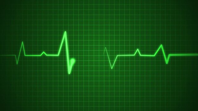Irregular heartbeat line flat start and end, showing a medical ecg pattern and heart rhythm problem animation