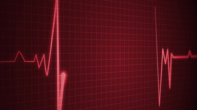 Heartbeat line irregular electrocardiogram signal animation
