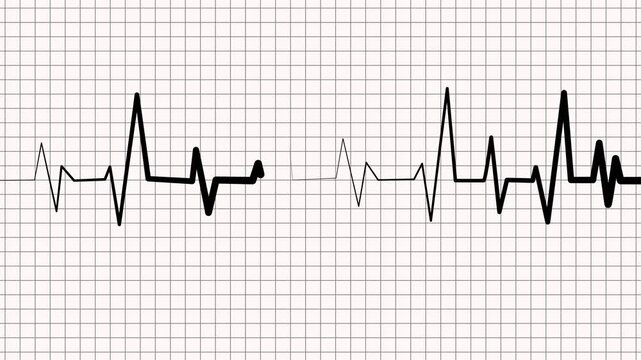 Heartbeat line on graph paper showing an ecg style rhythm pattern animation