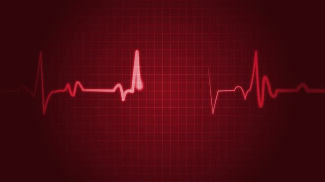 Ecg heartbeat line irregular pulse pattern medical background animation