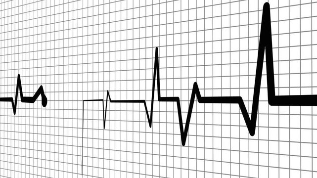 Heartbeat line irregular electrocardiogram pattern animation