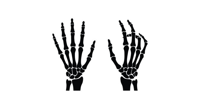 Two skeletal hands are depicted as black silhouettes against a white background anatomy bones cadaver
