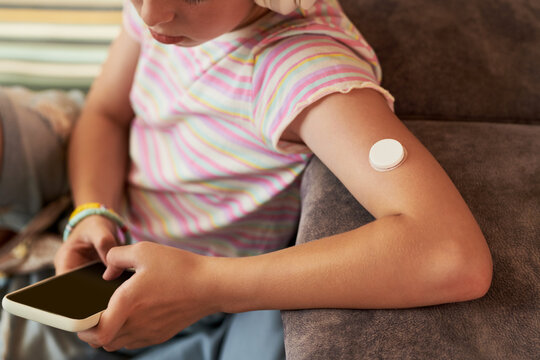 Caucasian child monitoring blood sugar levels using continuous glucose monitor on arm and smartphone. Useful for diabetes healthcare, digital medicine campaigns, close-up