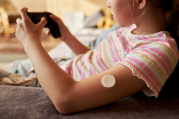 Caucasian child wearing continuous glucose monitor sensor on arm while playing video game with joystick controller. Useful for diabetes management and digital health tech marketing © pressmaster