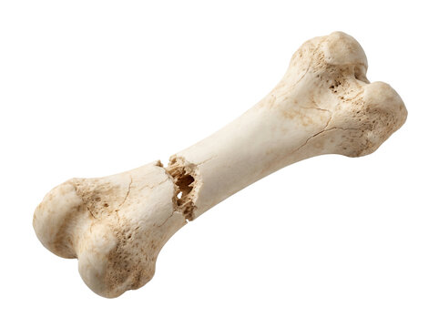 Single fractured long bone with a visible break