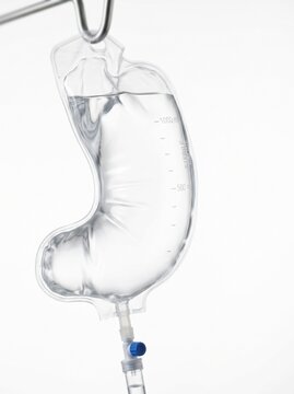 Intravenous saline drip bag shaped like a human stomach hanging on a pole, medical digestion concept.