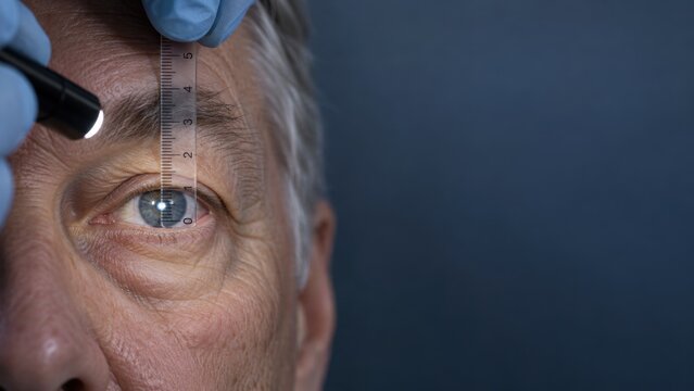 Close-up of elderly man eye exam with ruler and light device to measure pupil diameter and eye health