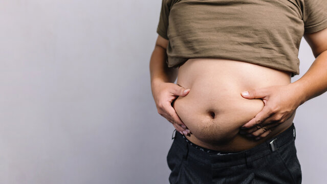 Overweight man pinching big belly fat flanks with both hands for male obesity visceral fat weight gain health risk medical healthcare and diet concept with copy space.