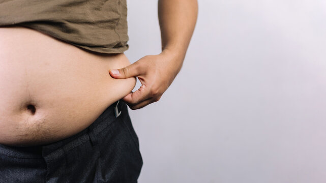 Close up overweight man pinching abdominal fat flab over big belly for male obesity visceral fat weight gain health risk medical healthcare and diet concept with copy space.