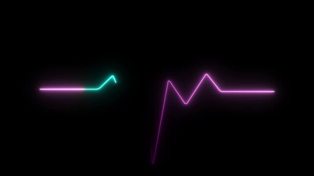 Pink and cyan neon electrocardiogram waveform on a dark background indicating a heart rhythm