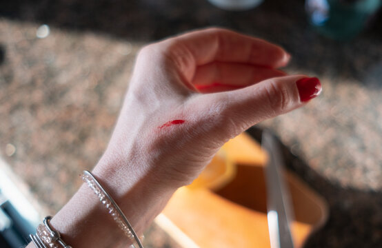 Close-up of a small bleeding scratch wound on a woman's hand in a kitchen. Domestic accident concept, minor skin injury, knife cut during cooking preparation, and first aid needed.