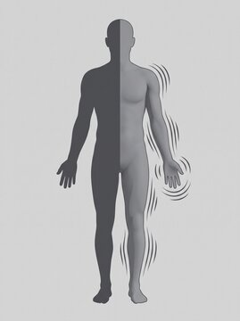 One-sided involuntary movement illustration