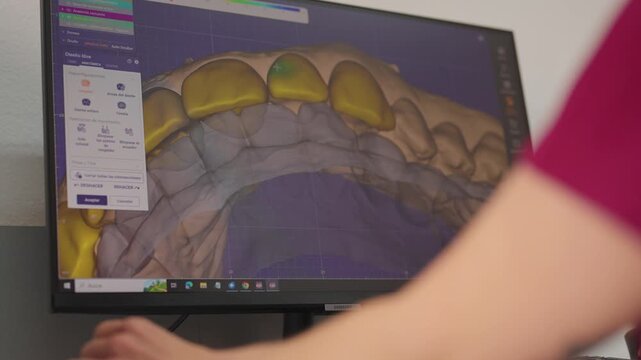 Digital dental arch model for orthodontic treatment planning