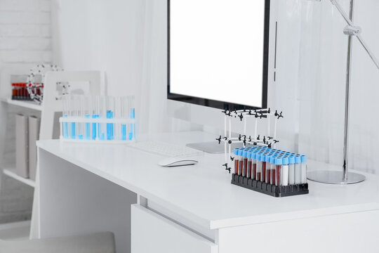 Medical research and clinical diagnostics, laboratory workspace with blood samples and computer monitor for data analysis in a modern science facility