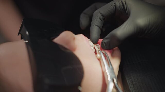 Close up of person mouth with braces during orthodontic procedure. gloved hand adjusts dental appliance focusing on precise manipulation and interaction between teeth and tools. scene is set