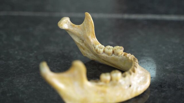 The jaw of a deceased person