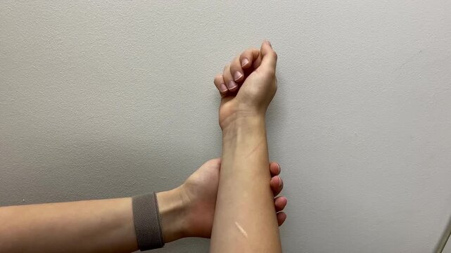 A scar on the girl&rsquo;s arm. 4k