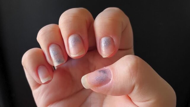 damaged fingernails with an uneven manicure, symbolizing nail problems, grooming issues and neglected hand care.