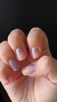 damaged fingernails with an uneven manicure, symbolizing nail problems, grooming issues and neglected hand care.