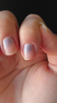 Close up of broken fingernails, illustrating damaged nails, an untidy manicure and poor nail care.