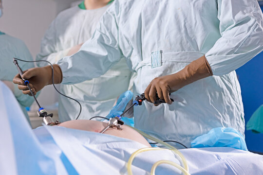 Laparoscopic surgery with instruments in abdominal cavity. Close-up laparoscopic surgery scene. Surgeon hands hold instruments inside abdomen. Medical process