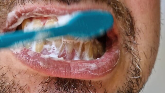 The process of brushing teeth with a brush and toothpaste with foam close-up. A man brushes his teeth with a blue toothbrush using white toothpaste. Close-up of the oral cavity, personal hygiene