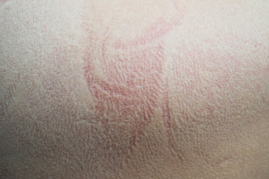 Red Irritated Skin Texture Close Up