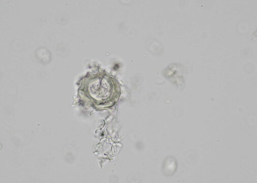 soil microorganisms under a microscope including amoeba, flagellates, nematodes, fungi, bacteria	