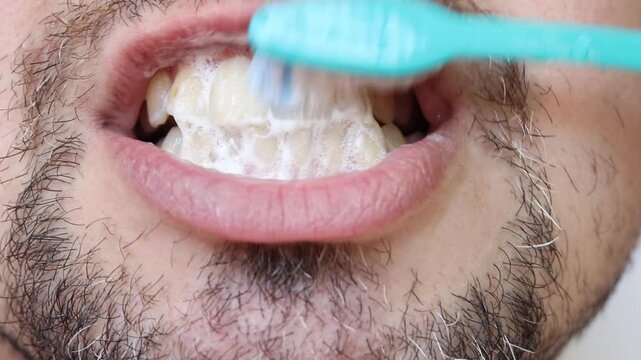 The process of brushing teeth with toothpaste. Daily oral hygiene of a man. A man with bristles brushes his teeth with a brush with the formation of white foam from the paste. Personal hygiene