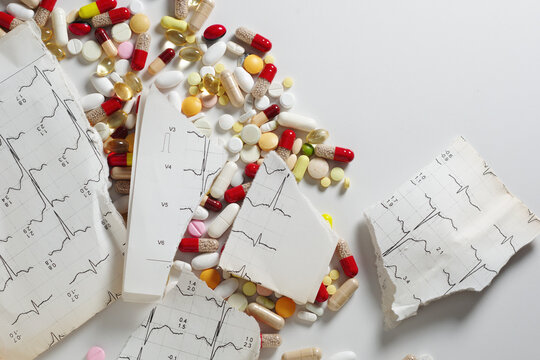 Scattered Pills and Torn ECG