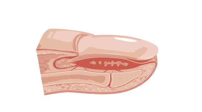 Human finger cross section showing nail and bone anatomy
