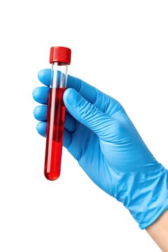 Gloved hand holding blood sample.