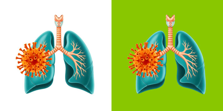 Human Lungs Anatomy Infected by Viral Disease Graphic Design