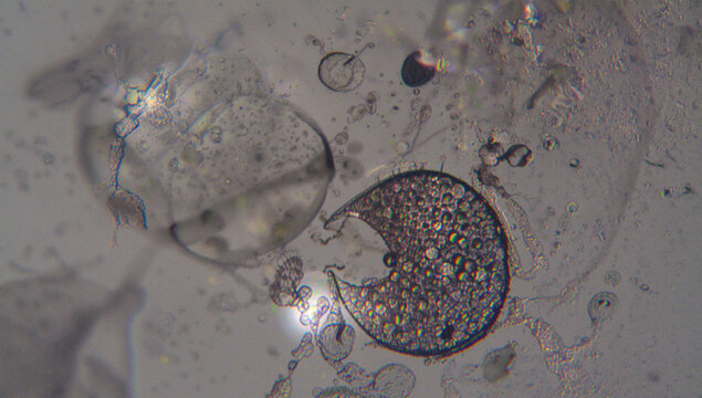微分干渉顕微鏡で見た透明な単細胞生物