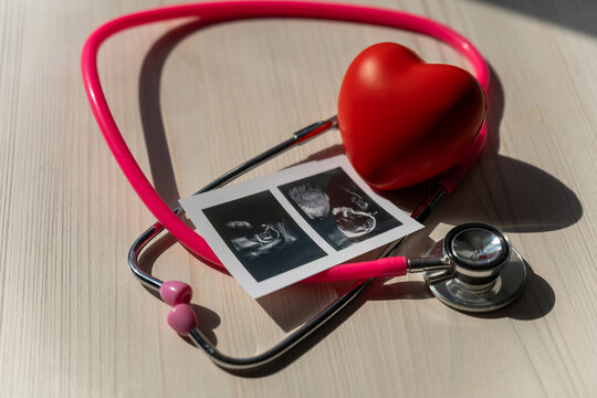 Photo: Ultrasound screening of a child and stethoscope. Image of an embryo.