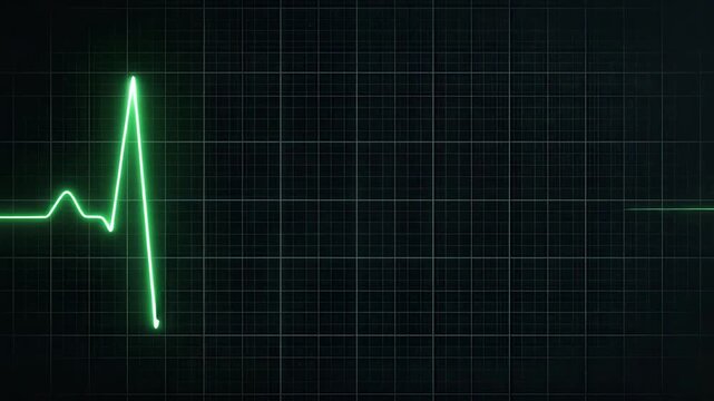 Green digital pulse line scrolling on dark grid